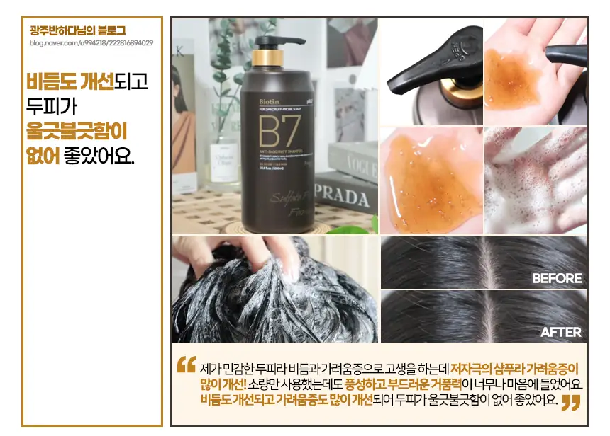 شامپو ضد شوره و ترمیم پوست سر فورست استوری Forest Story مدل B7 حجم 1000 میل